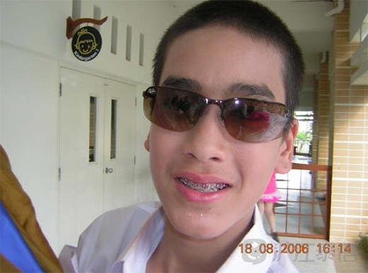 10位男星牙齿矫正前后照片大曝光!_新沪江泰语