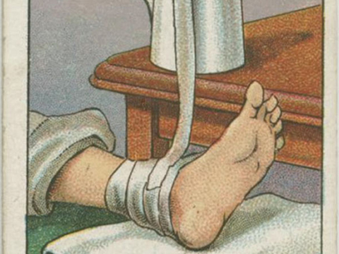 漫画英语_100年前的生活妙招:脚扭伤了,用冷水