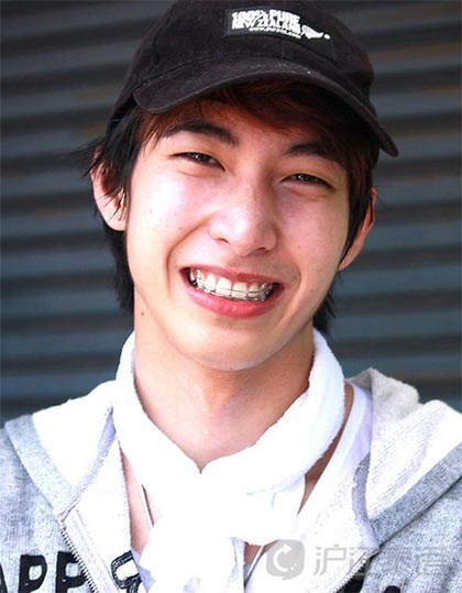 10位男星牙齿矫正前后照片大曝光!