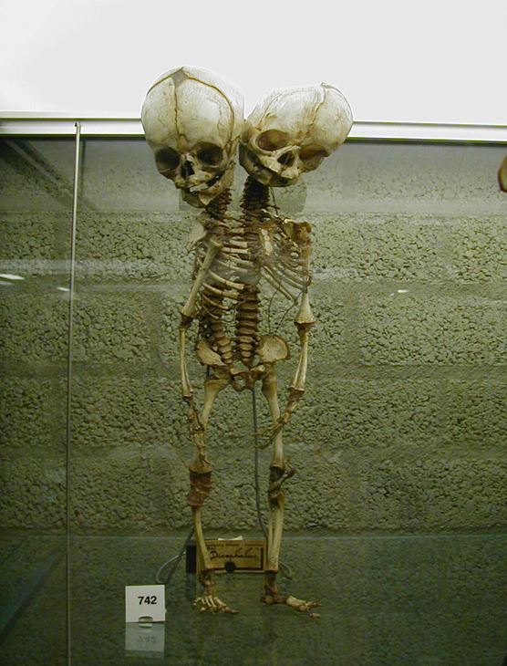 世界上6大最阴森的博物馆,足以让人心头一震!